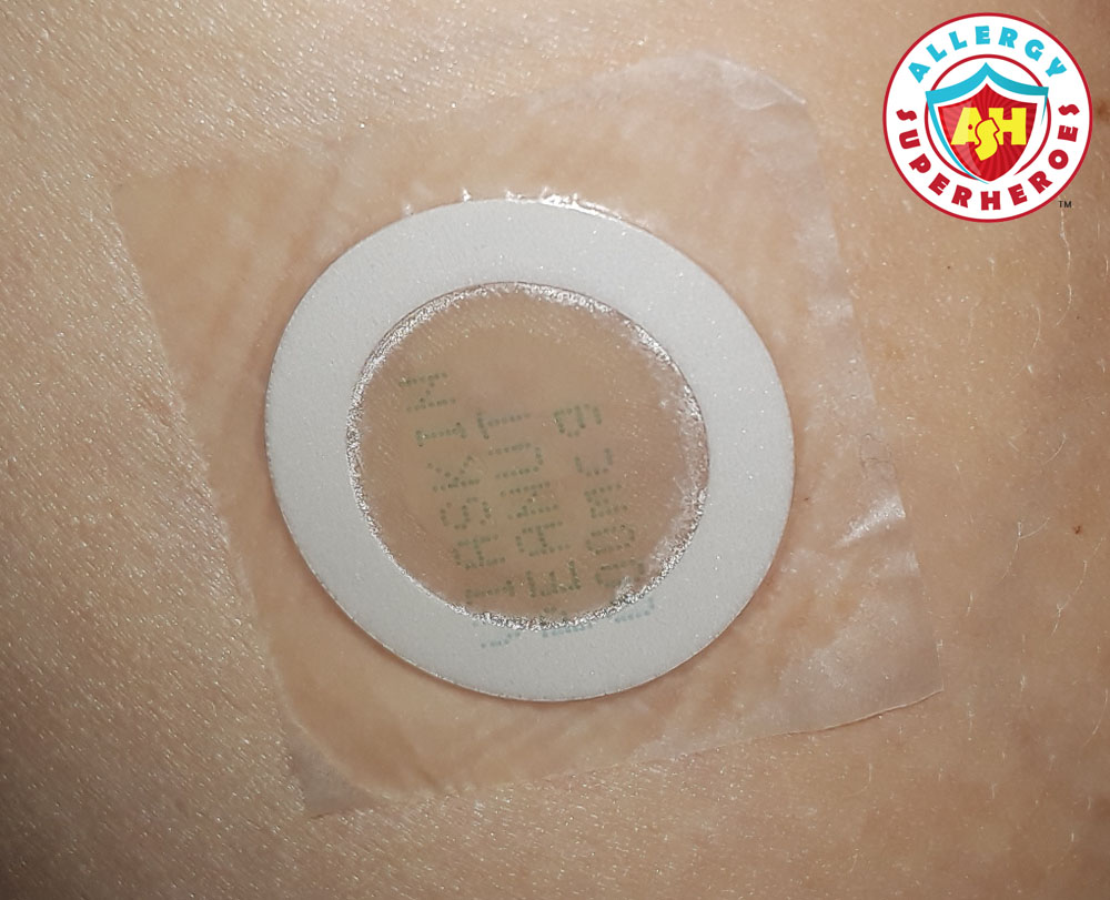 Close up of the peanut patch where the adhesive is coming loose on the edges | Food Allergy Superheroes